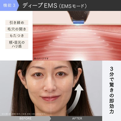 ミライワン　EMS